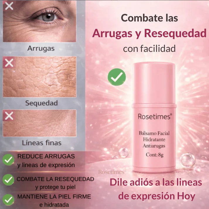 Rosetimes™ Bálsamo Facial Hidratante Antiarrugas, Piel sin Imperfecciones