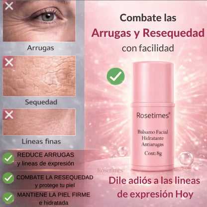 Rosetimes™ Bálsamo Facial Hidratante Antiarrugas, Piel sin Imperfecciones