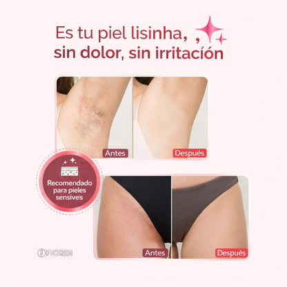 Depiladora eléctrica 4 en 1 - DermaFlex®