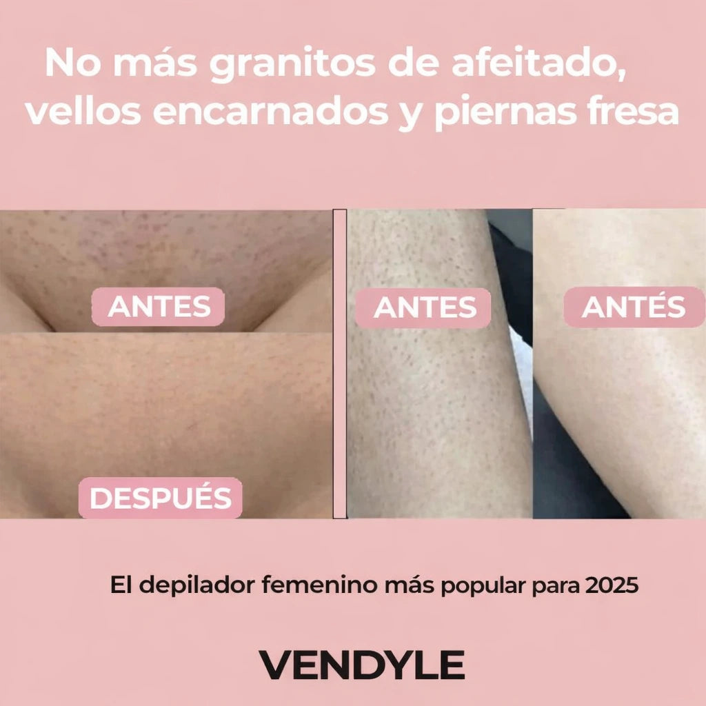 Depiladora corporal femenina Vendyle™ 2 en 1