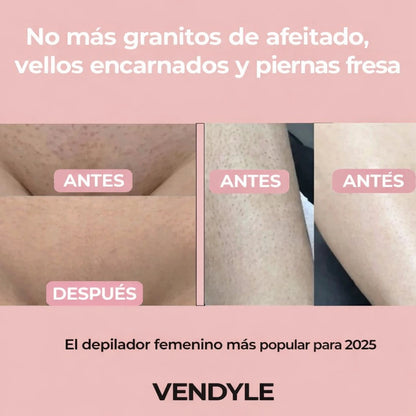 Depiladora corporal femenina Vendyle™ 2 en 1