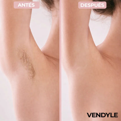 Depiladora corporal femenina Vendyle™ 2 en 1