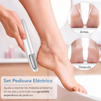 Cuidado de pies sin esfuerzo: removedor de callos eléctrico recargable