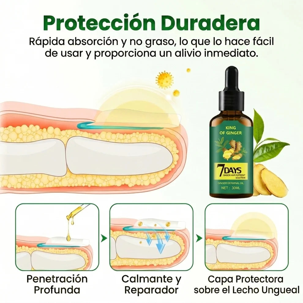 7Days™ Tratamiento Anti Hongos - Elimina Uñas Amarillas y las Fortalece desde 7 Días