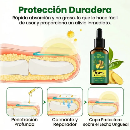7Days™ Tratamiento Anti Hongos - Elimina Uñas Amarillas y las Fortalece desde 7 Días