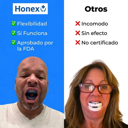 Boquilla antironquidos silenciosa de tamaño universal