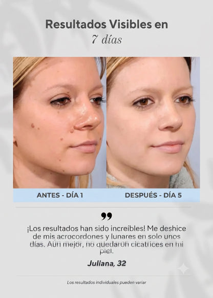 Lápiz para eliminar angiomas 6 en 1