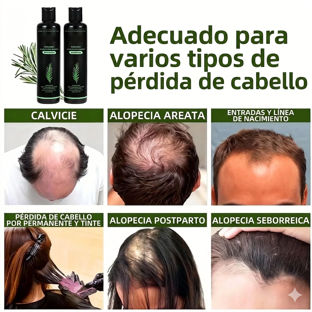 🌱 Champú orgánico de romero para el crecimiento del cabello