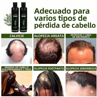 🌱 Champú orgánico de romero para el crecimiento del cabello