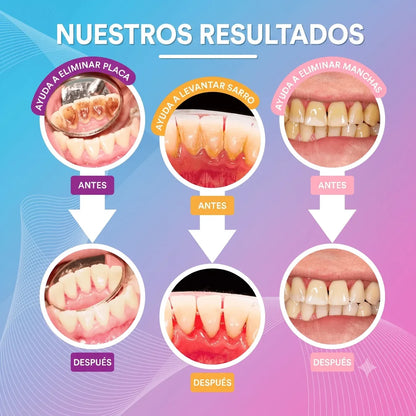 Recupera una sonrisa sin manchas — sin ir al dentista