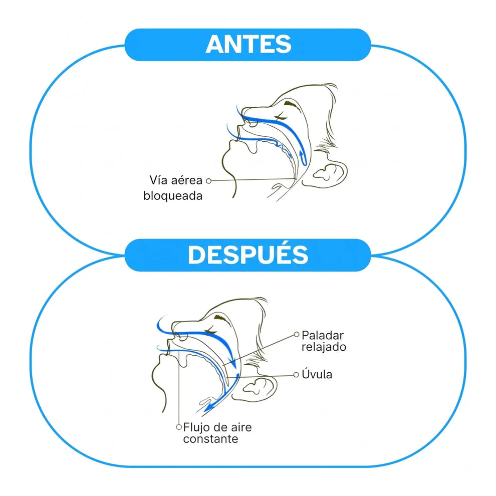 Duerme en silencio esta noche — sin tiras, sin cinta, sin CPAP