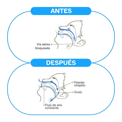 Duerme en silencio esta noche — sin tiras, sin cinta, sin CPAP