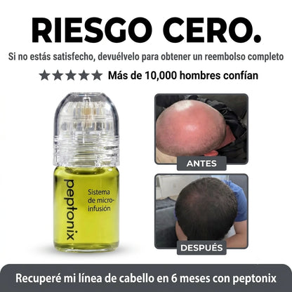 El sistema de infusión de péptidos más potente para el crecimiento del cabello